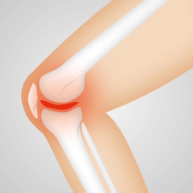 cum se tratează leziunile meniscului median al genunchiului