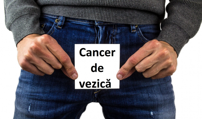 cancer vezica urinara barbati simptome)