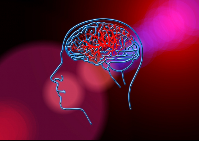 Fizioterapia după un accident vascular cerebral – Smart Medical