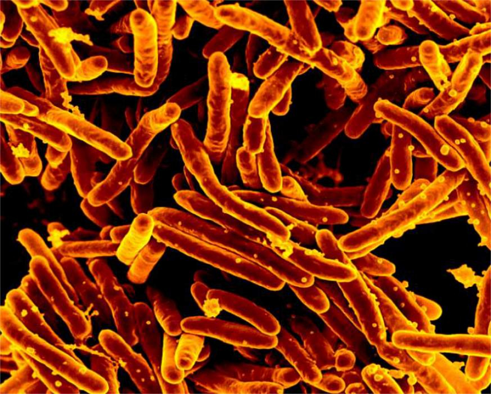 Bacteria mycobacterium tuberculosis, tuberculoza. sursa: niaid.nih.gov