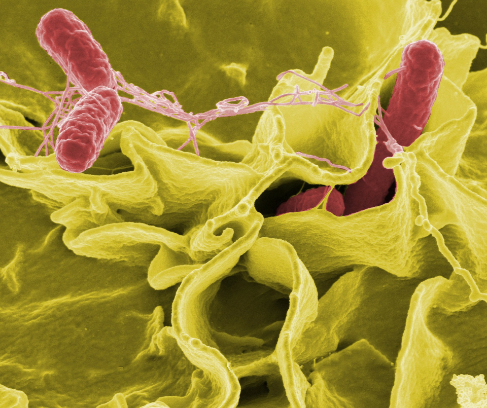 Microbiomul intestinal
