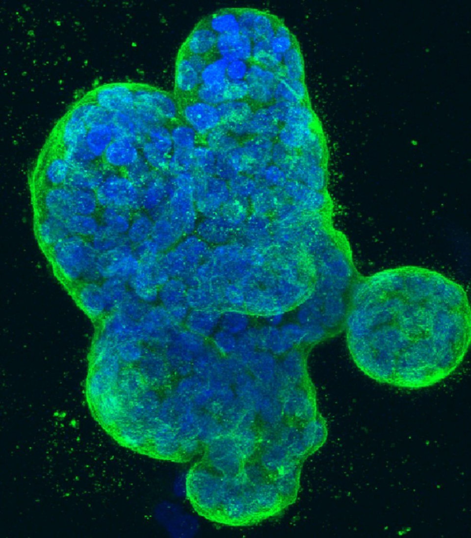 Cancer de sân triplu-negativ, Imaginea realizată în 2014 de doctorii în medicină Tom Misteli și Karen Meaburn, NIH