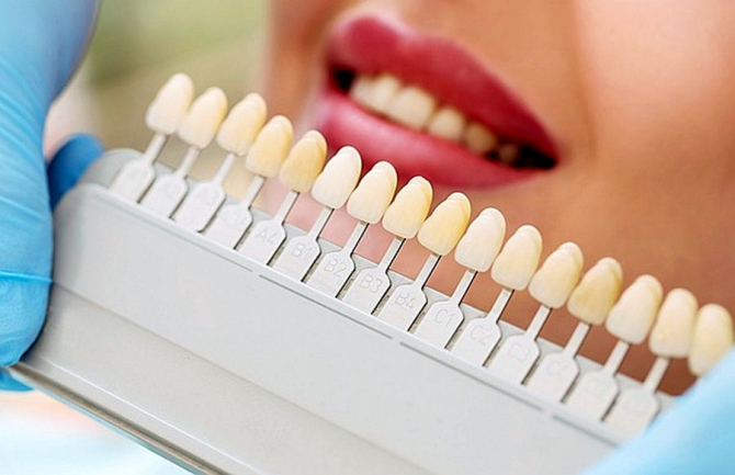 Albirea dinților cu metode naturale