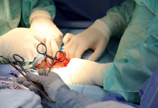 Operație de transplant