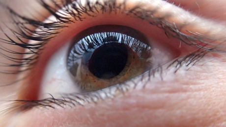 Care are o vedere foarte slabă Biomecanica vederii