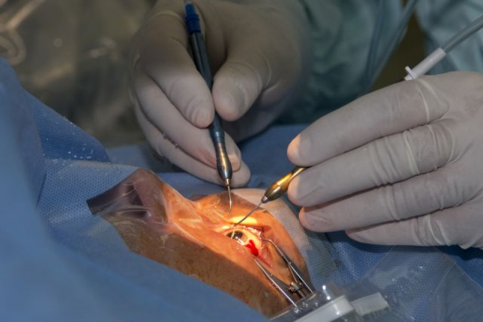 Transplant de cornee la Spitalul Militar Carol Davila