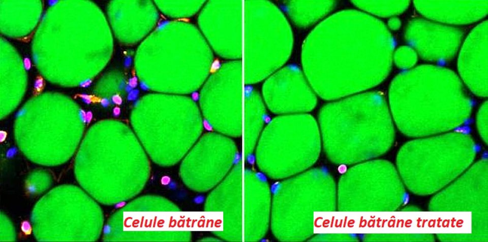 Diferența dintre celulele bătrâne (stânga) și cele tratate cu medicamentul pentru HIV (dreapta). Foto: Brown University