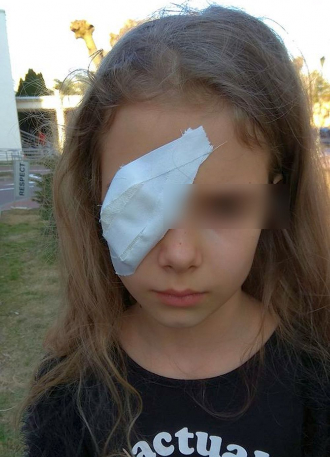 Fetița în vârstă de 8 anișori a ajuns de două ori la spital, după ce un coleg de joacă a lovit-o în ochi cu un băț. Foto Lucian Băltaru / Facebook