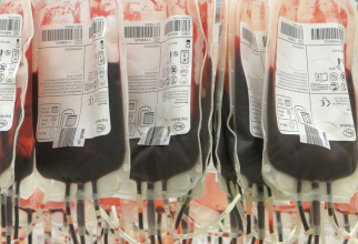 Transfuzii de sânge și plasmă