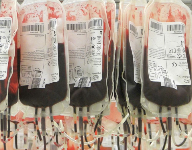 Transfuzii de sânge și plasmă