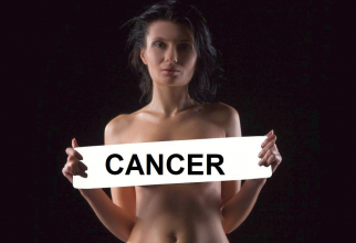 Cancerul de sân. Foto: Pixabay