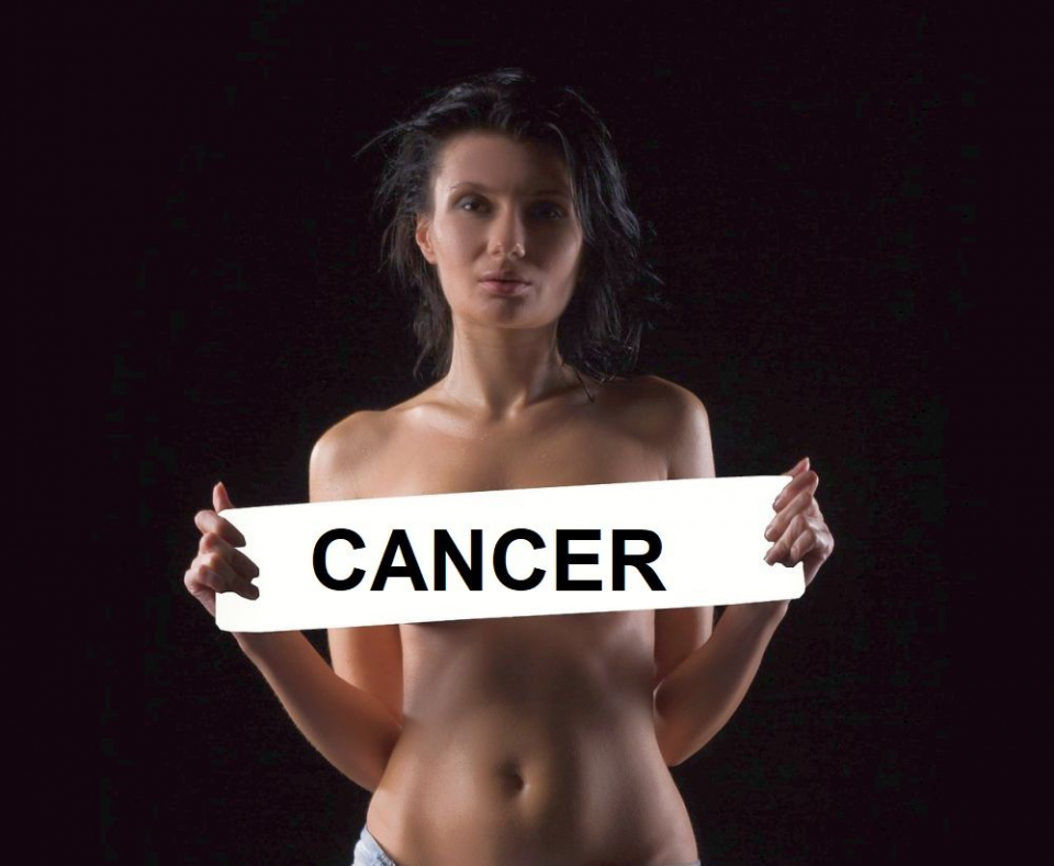 Cancerul de sân. Foto: Pixabay