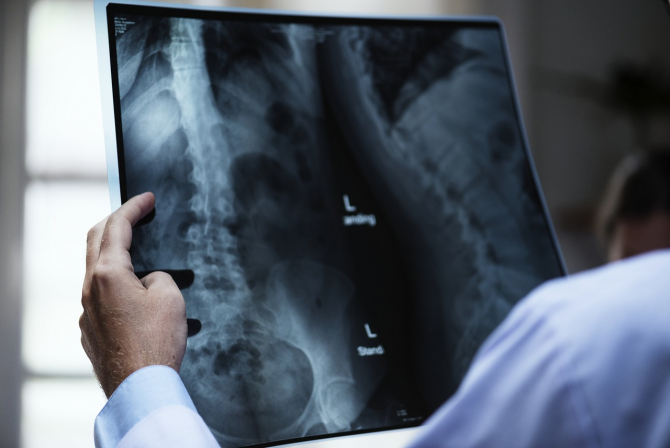 dureri severe în zona șoldului osteoartrită la nivelul scafoidului