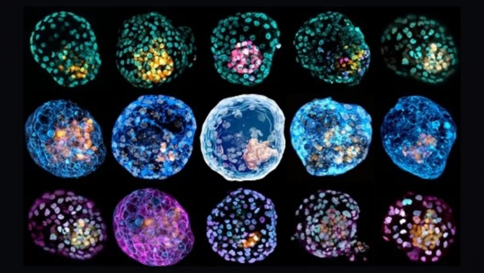 Celule realizate în laborator    Credit foto: Monash University/PA, Live Science