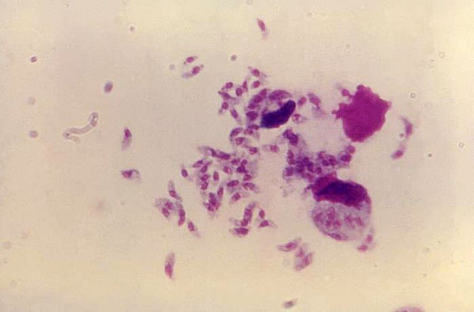 Toxoplasma gondii. Foto: Arhiva foto a CDC