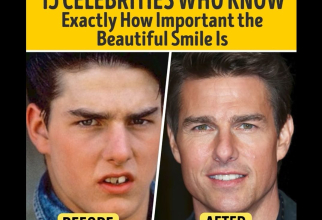 Tom Cruise, înainte și după ce și-a aranjat dantura. Foto: Print screen Bright Side 