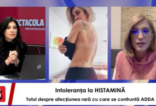 Adda, intoleranta a histamina    Sursa foto: Spectacola