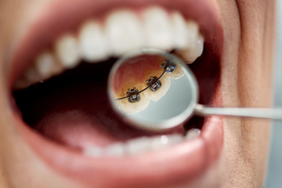 Care sunt cauzele gustului metalic in gura. FOTO Pexels