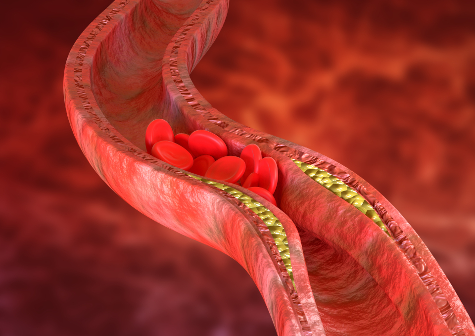 colesterolul din sange - FOTO: Freepick