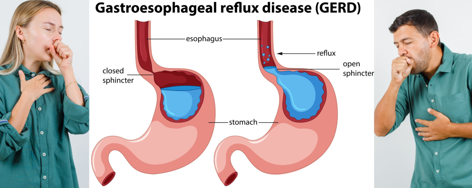 Care sunt simptomele refluxului gastroesofagian și ce să te trimită urgent la medic - Foto: Freepick
