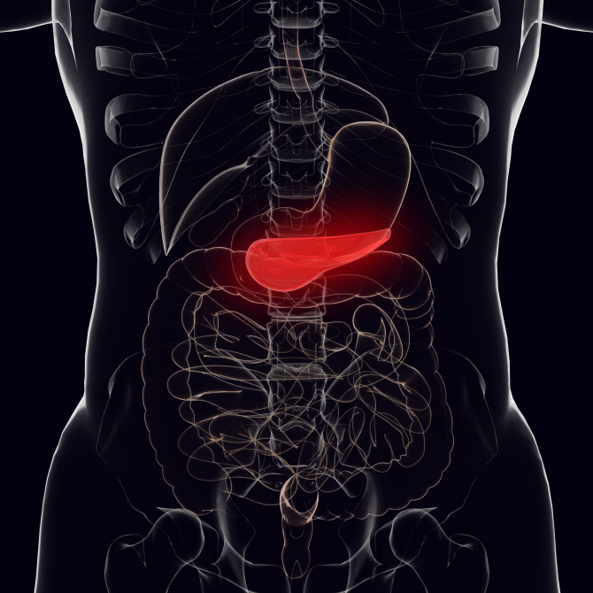 cancerul de pancreas - Foto: Freepick