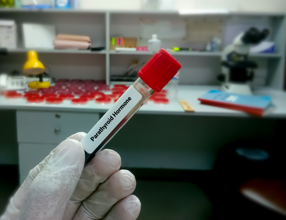 Testul care îți arată dacă ai hiperparatiroidism - Foto: Freepick @Saiful52
