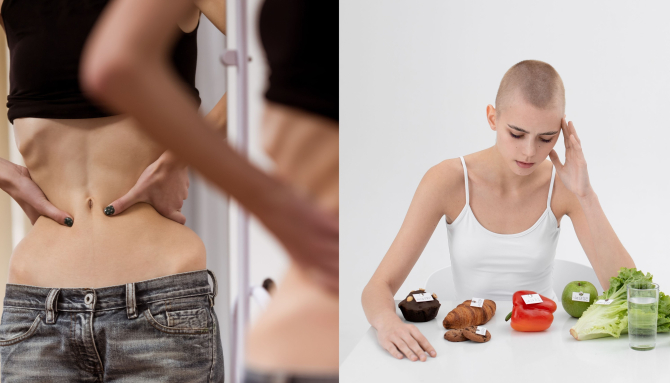 Sindromul de anorexie cașexie - Foto: Freepick @vgstockstudio