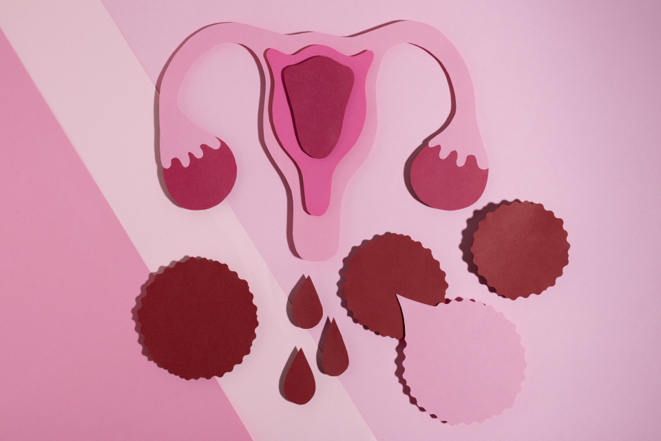 Sindromul ovarelor polichistice cauze, simptome, tratament - Foto: Freepick 