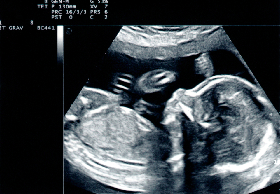 Cele 3 ecografii importante în sarcină - Foto: Freepick @copperpipe