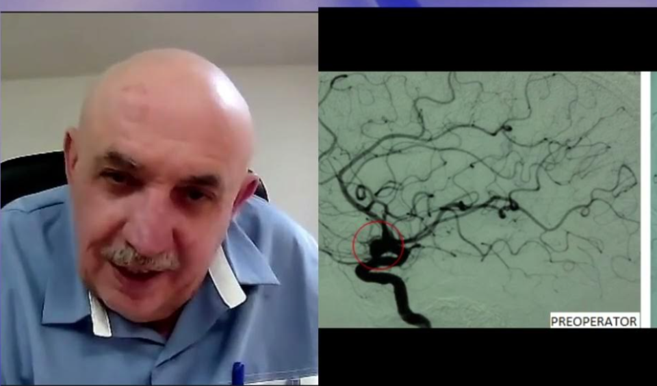 Chirurgia bolilor vasculare cerebrale. Dr. Corneliu Toader, la Academia de Sănătate
