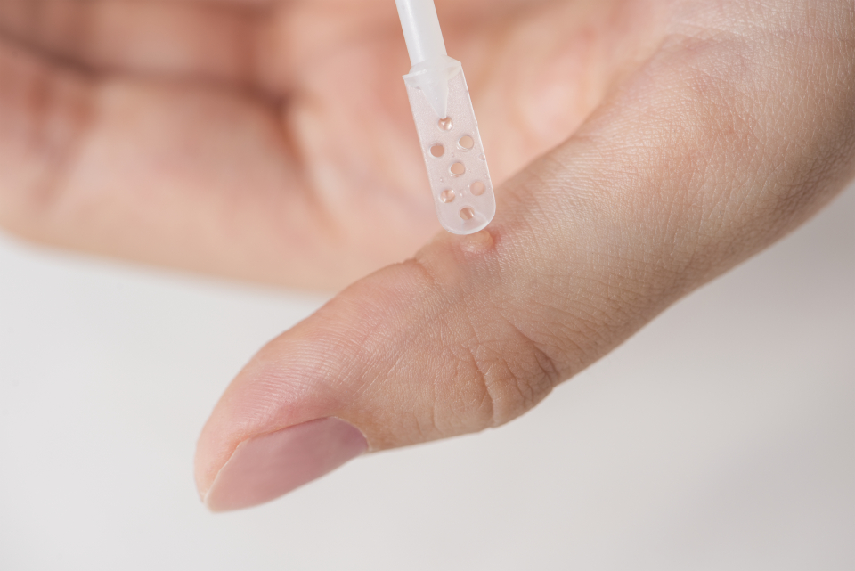 Testul care iti arata daca ai HPV - Foto: Freepik