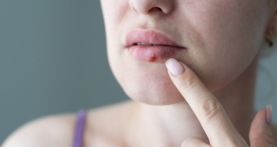 Herpes Alzheimer - Foto: Freepik @Gray StudioPro